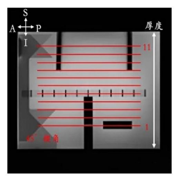 模體矢狀位圖像上定義橫軸位掃描范圍 模體矢狀位圖像上定義橫軸位掃描范圍