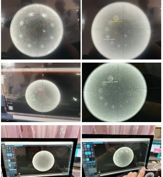 乳腺CBCT模體6 乳腺CBCT模體6